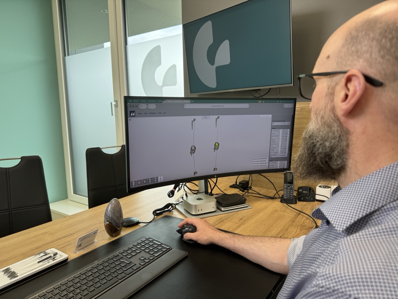Dr. Gröbner bei der digitalen OP-Planung am Bildschirm